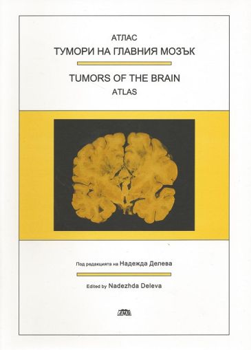 Тумори на главния мозък - Атлас