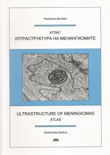 Ултраструктура на менингиомите - атлас
