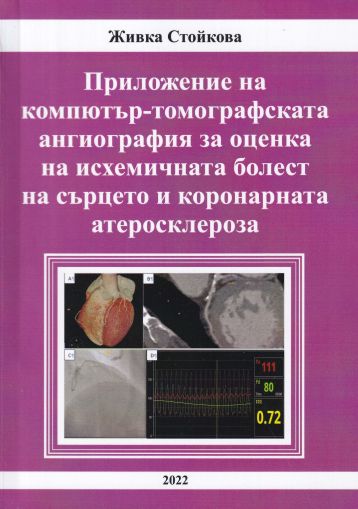 Приложение на компютър-томографската ангиография за оценка на исхемичната болест на сърцето и коронарната ателосклероза
