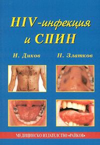 HIV-инфекция и СПИН