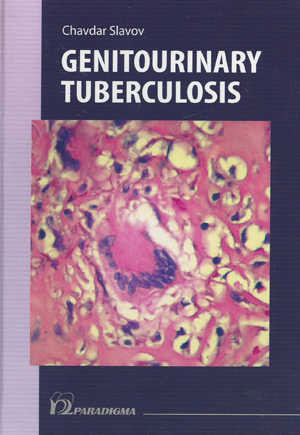 Genitourinary Tuberculosis