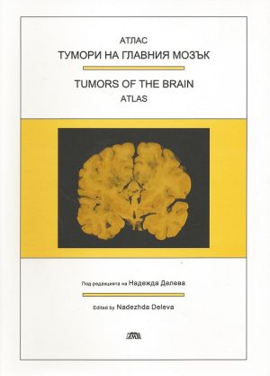 Тумори на главния мозък - Атлас