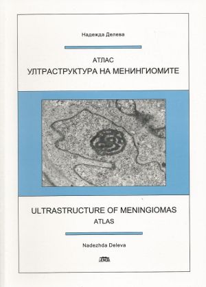 Ultrastructure of Meningiomas - Atlas