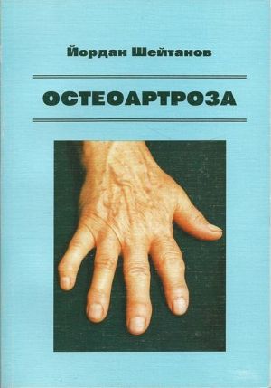 Остеоартроза
