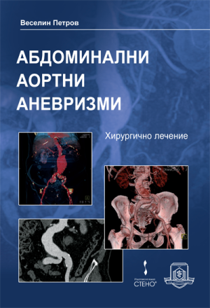 Абдоминални аортни аневризми – хирургично лечение 