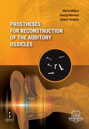 Prostheses for Reconstruction of the Auditory Ossicles