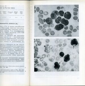 Цитодиагностика и диференциална диагноза на кръвните болести