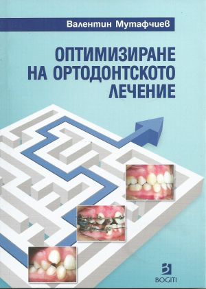 Оптимизиране на ортодонтското лечение