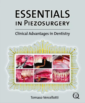 Essentials in Piezosurgery