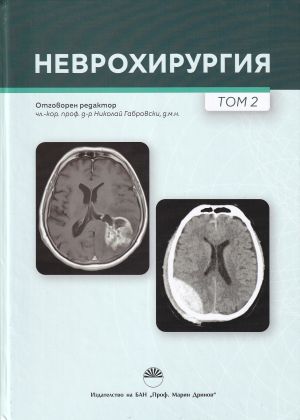 Неврохирургия - том 2
