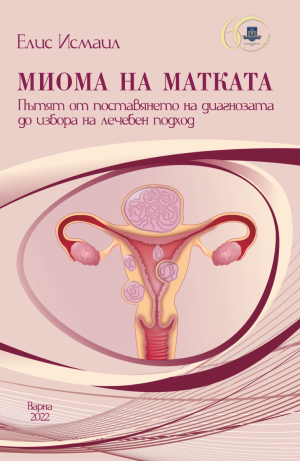 Миома на матката